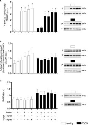 Transforming Growth Factor Beta 1 Alters Glucose Uptake but Not Insulin Signalling in Human Primary Myotubes From Women With and Without Polycystic Ovary Syndrome